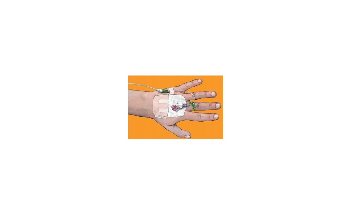 IV3000 Пов'язка для фіксації проколів 1-HAND 10* 12см 1шт - Зображення 2
